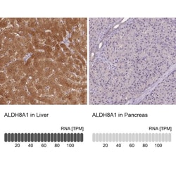 ALDH8A1 Antibody, Novus Biologicals 0.1mL; Unlabeled:Antibodies, Polyclonal